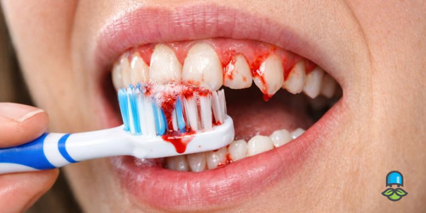 دندانپزشک چگونه علت خونریزی لثه را تشخیص میدهد؟